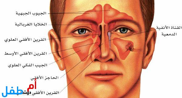 علاج التهاب الجيوب الأنفية بالأعشاب